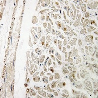 Anti-MYF6 Antibody