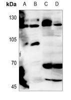 CD56 Rabbit Polyclonal Antibody