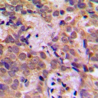 NF-kappaB p105 (Phospho-S932) Antibody