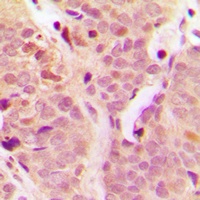 NF-kappaB p105 Rabbit Polyclonal Antibody