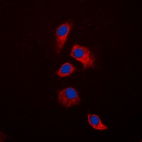 Anti-Osteoprotegerin Antibody