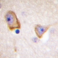 Anti-Mu Opioid Receptor Antibody