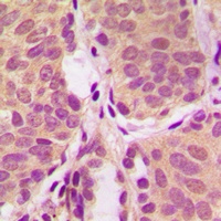Anti-PI3K p85 alpha Antibody
