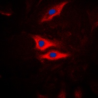 Anti-PLA2G4A (Phospho-S505) Antibody