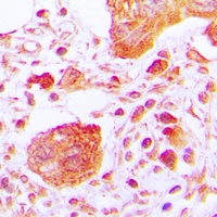 PLC gamma 1 (Phospho-Y783) Antibody