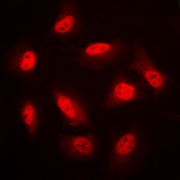 Anti-AMPK beta 1 Antibody