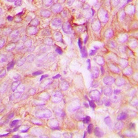 Anti-PKC delta (Phospho-Y313) Antibody