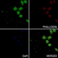 Anti-PKC delta (Phospho-Y313) Antibody
