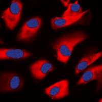 PRKCZ antibody