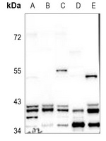 ERK2 Rabbit Polyclonal Antibody