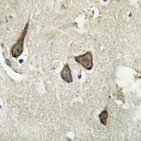 ERK2 Rabbit Polyclonal Antibody