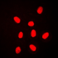 Anti-ERK3 Antibody