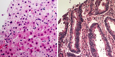AEC Chromogen Kit