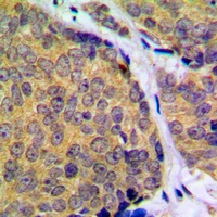 Anti-MKK2 (Phospho-T394) Antibody