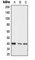 MKK3/6 Rabbit Polyclonal Antibody