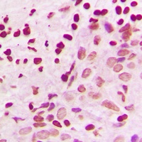 MKK3/6 Rabbit Polyclonal Antibody