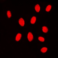MKK3/6 Rabbit Polyclonal Antibody