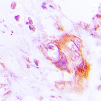 Anti-PKR (Phospho-T451) Antibody