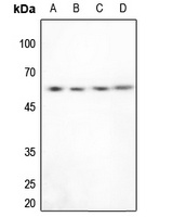 PTEN Rabbit Polyclonal Antibody