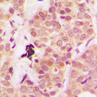 Anti-PTEN Antibody