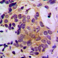 Anti-SHPTP2 Antibody