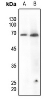 Paxillin (Phospho-Y118) Antibody