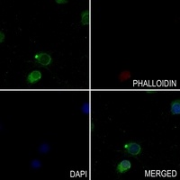 Paxillin (Phospho-Y118) Antibody