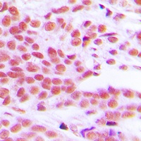 NFkB p65 (phospho-S529) antibody
