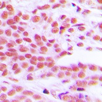 Anti-NF-kappaB p65 (Phospho-S529) Antibody