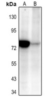 NF-kappaB p65 (Acetyl-K310) Antibody