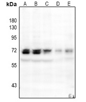 NF-kappaB p65 (Phospho-S529) Antibody