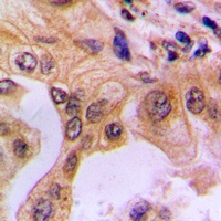 Anti-NF-kappaB p65 (Phospho-S529) Antibody