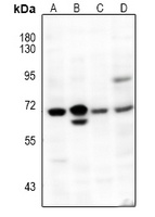 NF-kappaB p65 Antibody