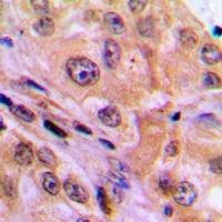 NF-kappaB p65 Antibody