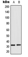 RPS6 (Phospho-S235) Antibody