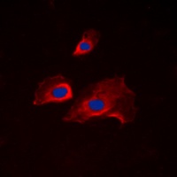 RPS6 (Phospho-S235) Antibody