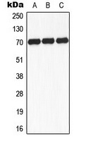 S6K1 (Phospho-S434) Antibody