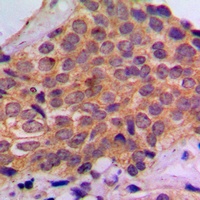 S6K1 (Phospho-S434) Antibody