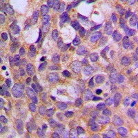 Anti-S6K1 (Phospho-T444) Antibody