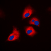 Anti-S6K1 (Phospho-T444) Antibody
