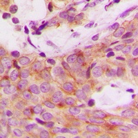 Anti-S6K1 (Phospho-S447) Antibody