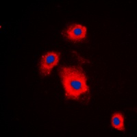 S6K1 (phospho-S447) antibody