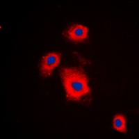 Anti-S6K1 (Phospho-S447) Antibody