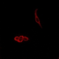 Anti-Delta-NaCH Antibody