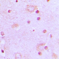 Anti-SRSF7 Antibody