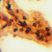 Anti-BAF170 Antibody