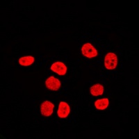 Anti-BAF170 Antibody