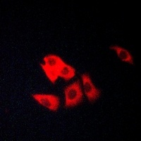 Matriptase Antibody