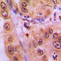 Anti-STAT3 (Phospho-Y705) Antibody