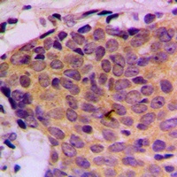 STAT5 Antibody